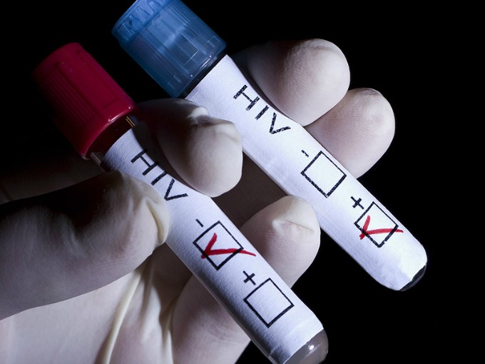 test hiv Časopis Vangardist zaražen HIV om
